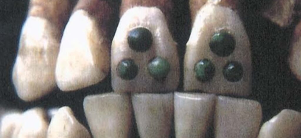 Jaded Inlays 2.